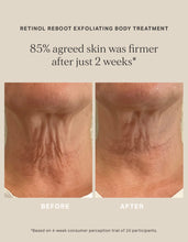 Afbeelding in Gallery-weergave laden, Retinol Reboot Exfoliating Body Treatment
